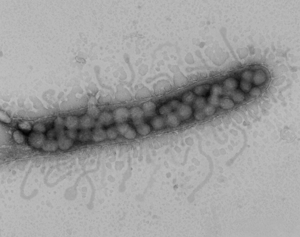 Una bacteria SAR11 infectada por bacteriófagos.